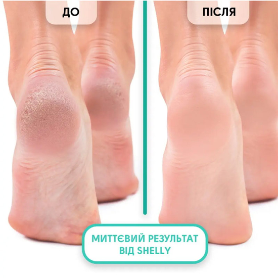 Пінний експрес-розм'якшувач для педикюру Shelly М'яке лезо 150 мл2