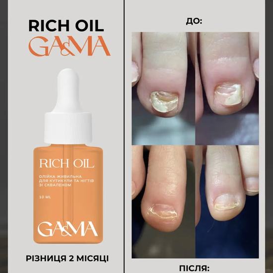 Масло питательное GaMa Rich Oil со скваленом 10 мл, Объем: 10 мл
2