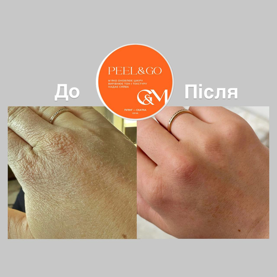 Пілінг-скатка GA&MA + Peeling Peel&Go 50 мл2